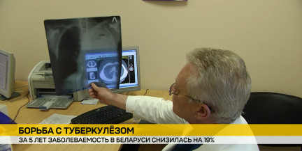 Минздрав назвал ключевые факторы снижения заболеваемости туберкулезом в Беларуси