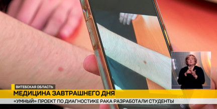 Студенты Витебского госуниверситета разработали приложение для диагностики рака и других кожных заболеваний