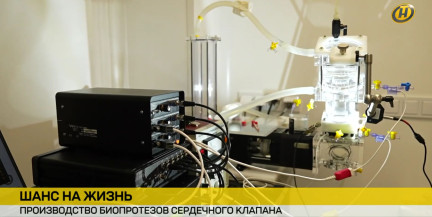 Прорыв в кардиохирургии: пациенты получают второе сердце – с частичкой Беларуси внутри