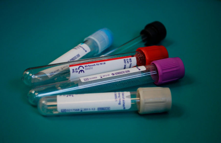 В Россию мигрантов будут впускать только после теста на ВИЧ