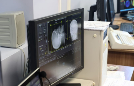 «Первые симптомы инсульта могут быть малозаметны». Специалист рассказал, когда обязательно надо обратиться за помощью