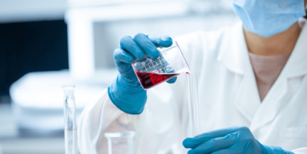 Independent: в Индии пытаются сдержать вспышку опасного вируса Нипах