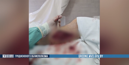 Житель Гродненской области получил огнестрельные ранения в Польше – МВД