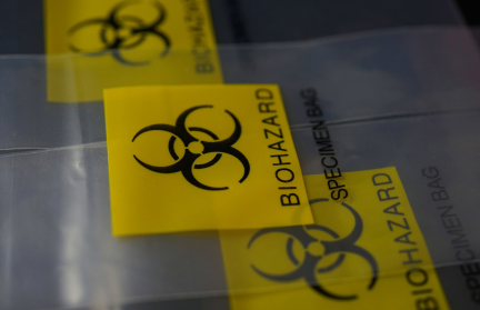 Ученые предупредили об угрозе новой пандемии вируса, переносимого грызунами