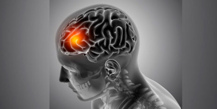 Нарколог назвал основную причину ускоренного старения мозга
