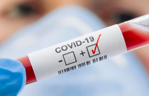 Беларусь планирует участвовать в клинических наблюдениях ВОЗ по лечению коронавируса