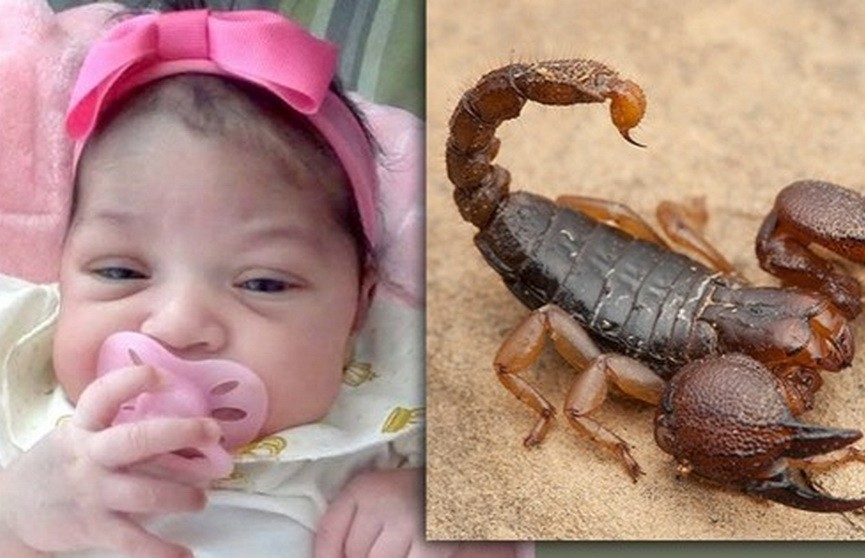 Новорождённая девочка выжила после семи укусов скорпиона