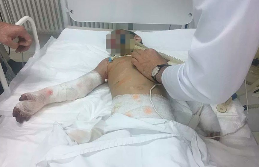 Изувеченную в Ингушетии девочку выписали из больницы
