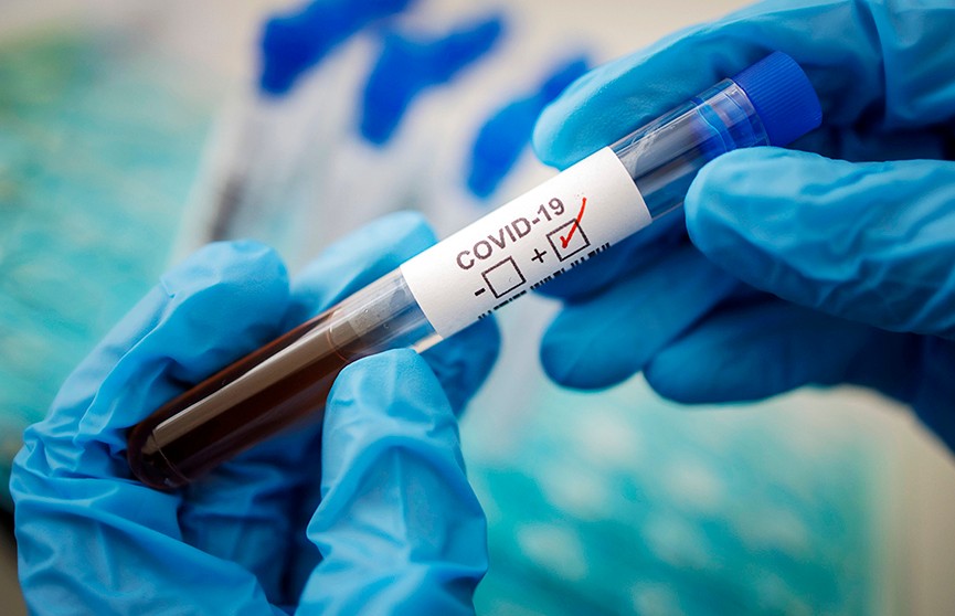 Россия вышла на второе место в мире по количеству заразившихся COVID-19