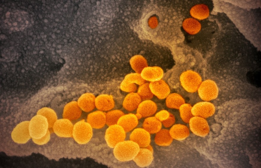 Как выглядит коронавирус под микроскопом? Опубликованы первые фото