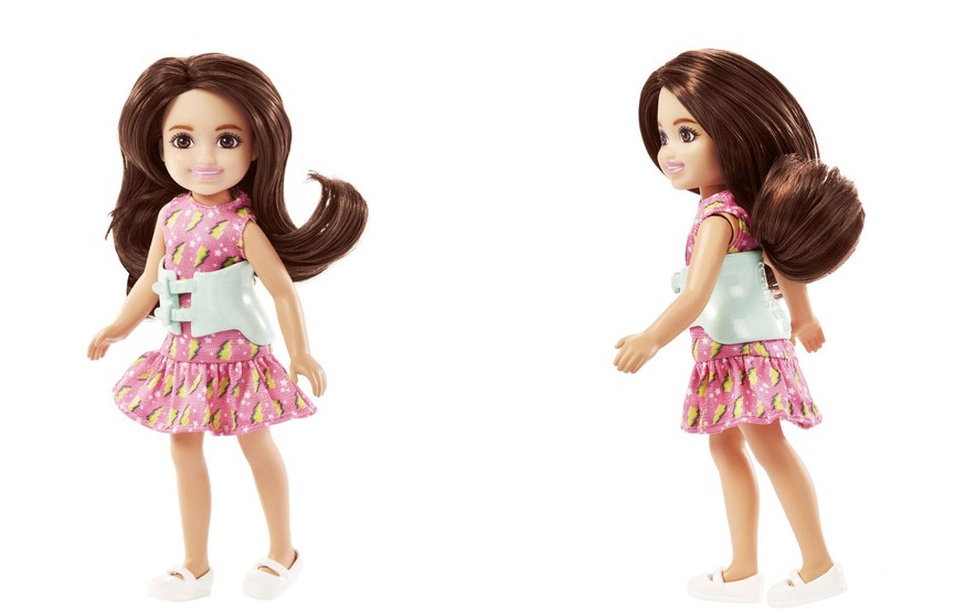 В линейке Barbie появилась первая кукла со сколиозом