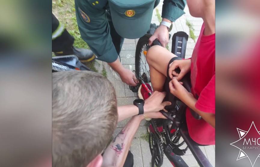 В Витебске спасатели помогали ребенку, нога которого оказалась зажата в велосипеде
