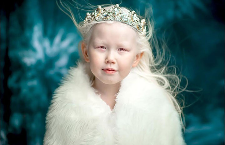 Якутская «Белоснежка»: девочка-альбинос покорила Интернет необычной внешностью