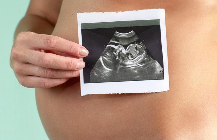 Художница нарисовала снимок УЗИ на животе беременной подруги и удивила Сеть