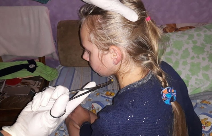 Сотрудники МЧС помогли 12-летней девочке достать застрявшую в ухе серёжку (ВИДЕО)