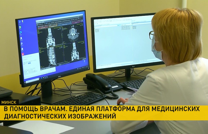 В Беларуси появится республиканская электронная база с аппаратов УЗИ, МРТ, КТ и рентгена