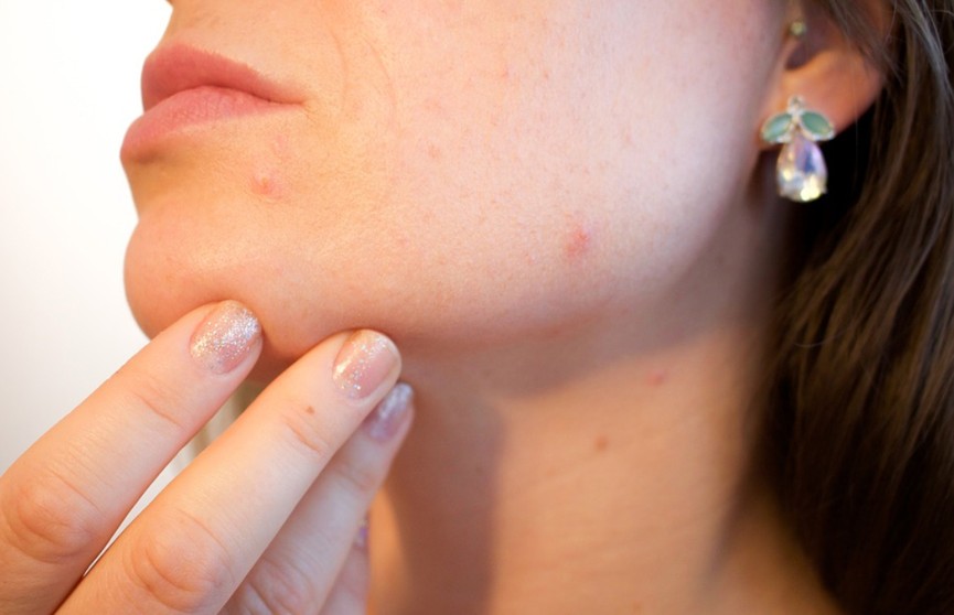 Какое питание и процедуры нужны, чтобы кожа на лице была здоровой? А когда стоит обратиться к дерматологу? Рассказывает врач