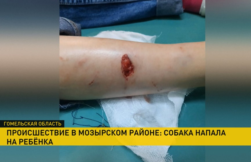 В Мозырском районе собака напала на девятилетнюю девочку. У ребенка рваные раны