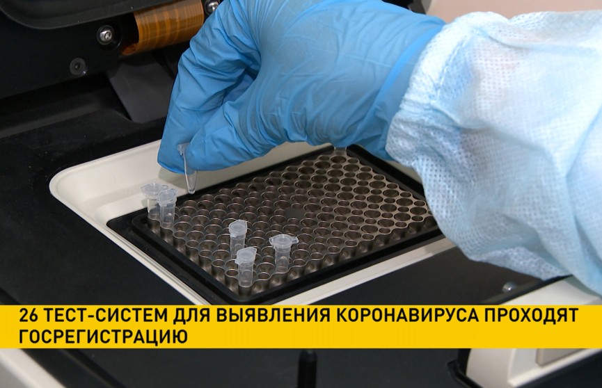 26 тест-систем для выявления коронавируса проходят регистрацию в Беларуси