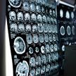 Теперь и на людях: Neuralink открыла набор участников клинических испытаний мозговых имплантов