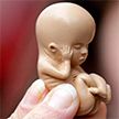 Аборт: что толкает женщину прервать беременность?
