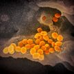 Как выглядит коронавирус под микроскопом? Опубликованы первые фото