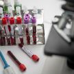 Вакцинация населения Беларуси от COVID-19 может стартовать в 2021 году