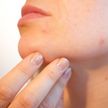 Какое питание и процедуры нужны, чтобы кожа на лице была здоровой? А когда стоит обратиться к дерматологу? Рассказывает врач