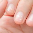 «Не очень хорошая примета»: врач предупредила об опасности белых пятен на ногтях