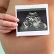 Художница нарисовала снимок УЗИ на животе беременной подруги и удивила Сеть