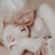 Сестры-альбиносы завоёвывают модельный мир: фото, согревающие сердца