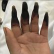После уборки у китаянки почернели пальцы на руке
