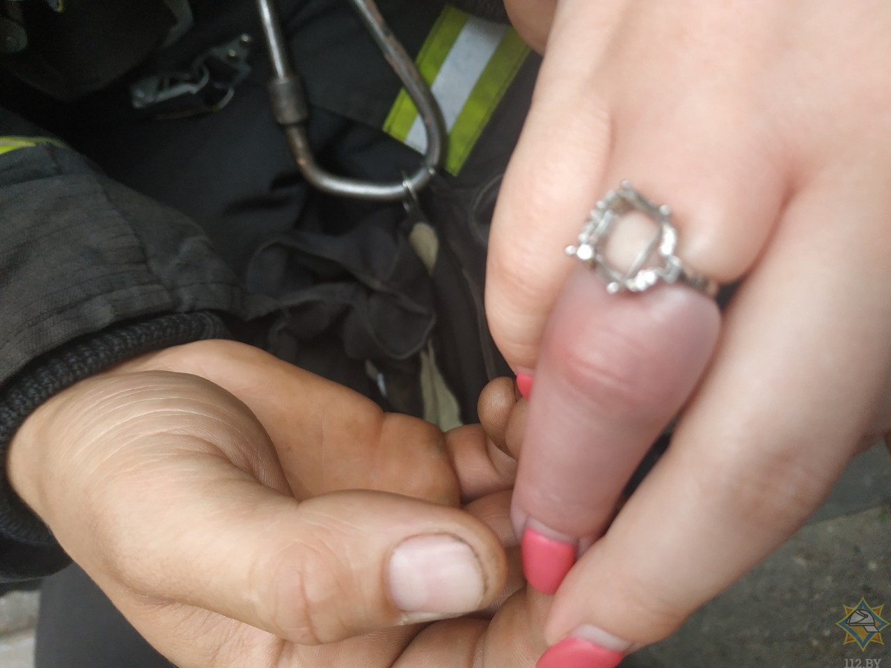 Неснимаемое кольцо на пальце
