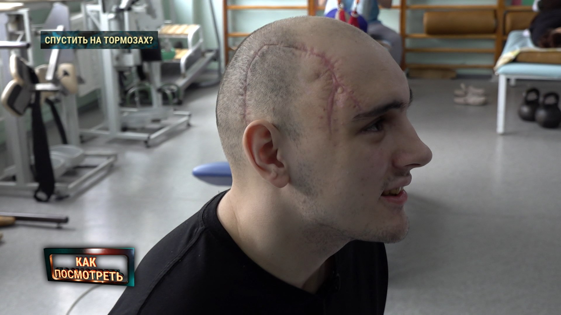 Илья, пациент Аксаковщины: зашита часть головы, на электровеле прыгнул в кирпичную стену
